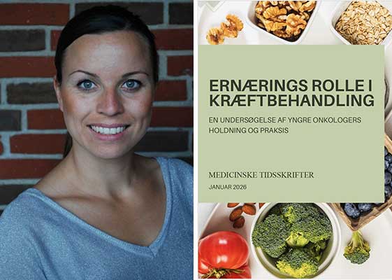 Unders&oslash;gelse: Der mangler systematiske ern&aelig;ringsindsatser til onkologiske patienter